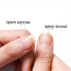 Takaz Global Tırnak Yağı Canladırıcı Bakım Kalemi 2 li Paket